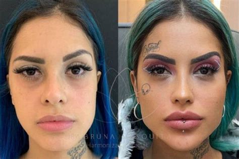 tati zaqui|tati zaqui antes e depois.